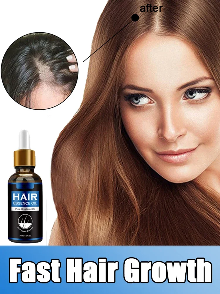 

Быстрое масло для роста волос, лечение кожи головы, мощный Восстанавливающий облысение, фолликулы, гегентические волосы, Послеродовая себорореевая профилактическая сыворотка