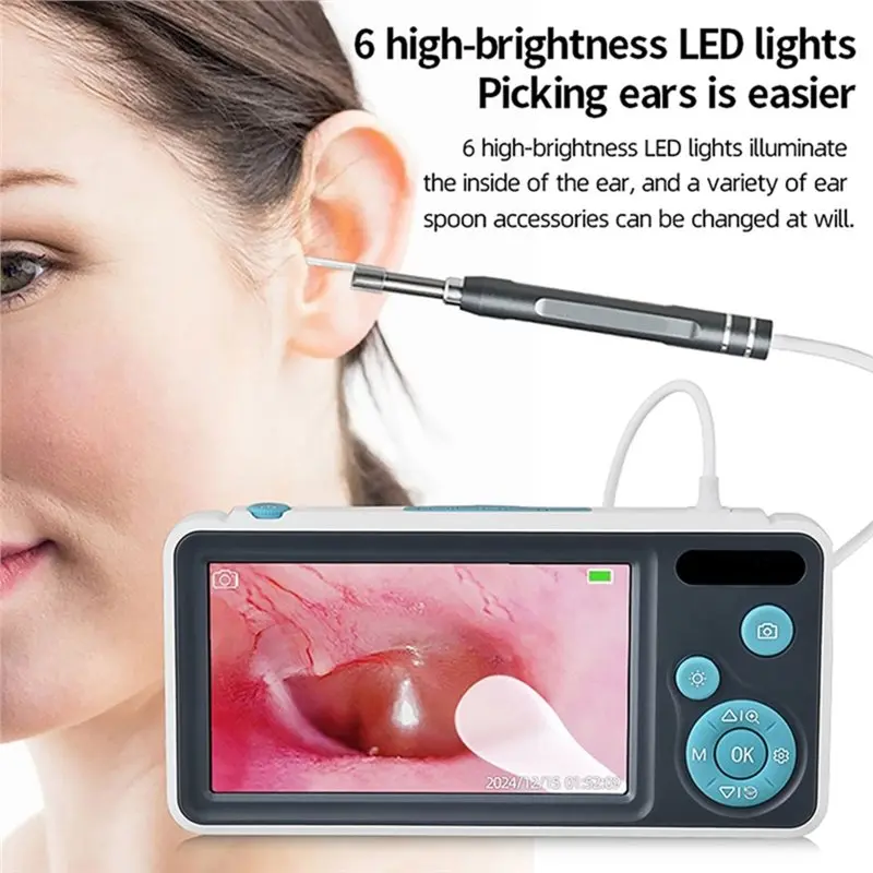 【CYBER MONDAY】Digital Ear Camera Otoscope With 1080P IPS Screen For Kids Home Ear Inspection Cleaning Cleaner
