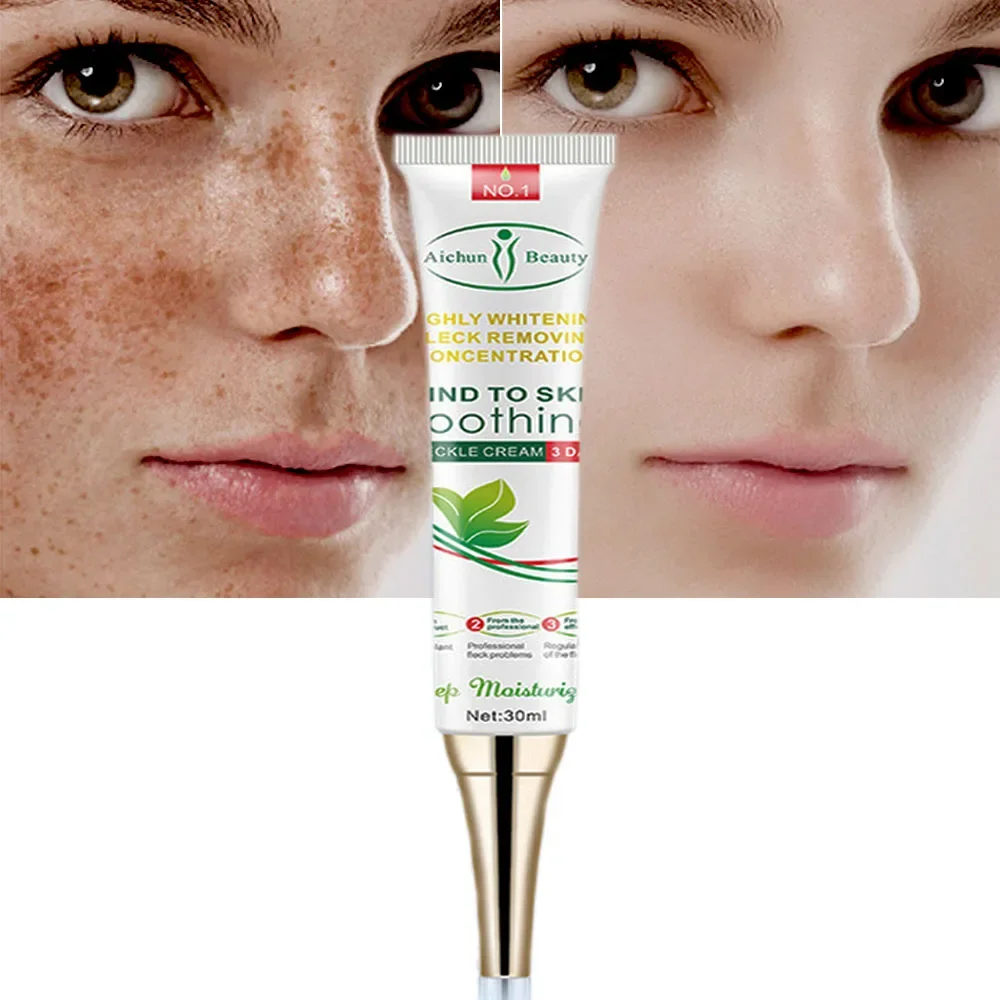 Skin Care Effective Whitening Freckle Cream Remove Melasma Acne Spot Pigment Melanin Dark Spots Pigmentation Moisturizing Gel