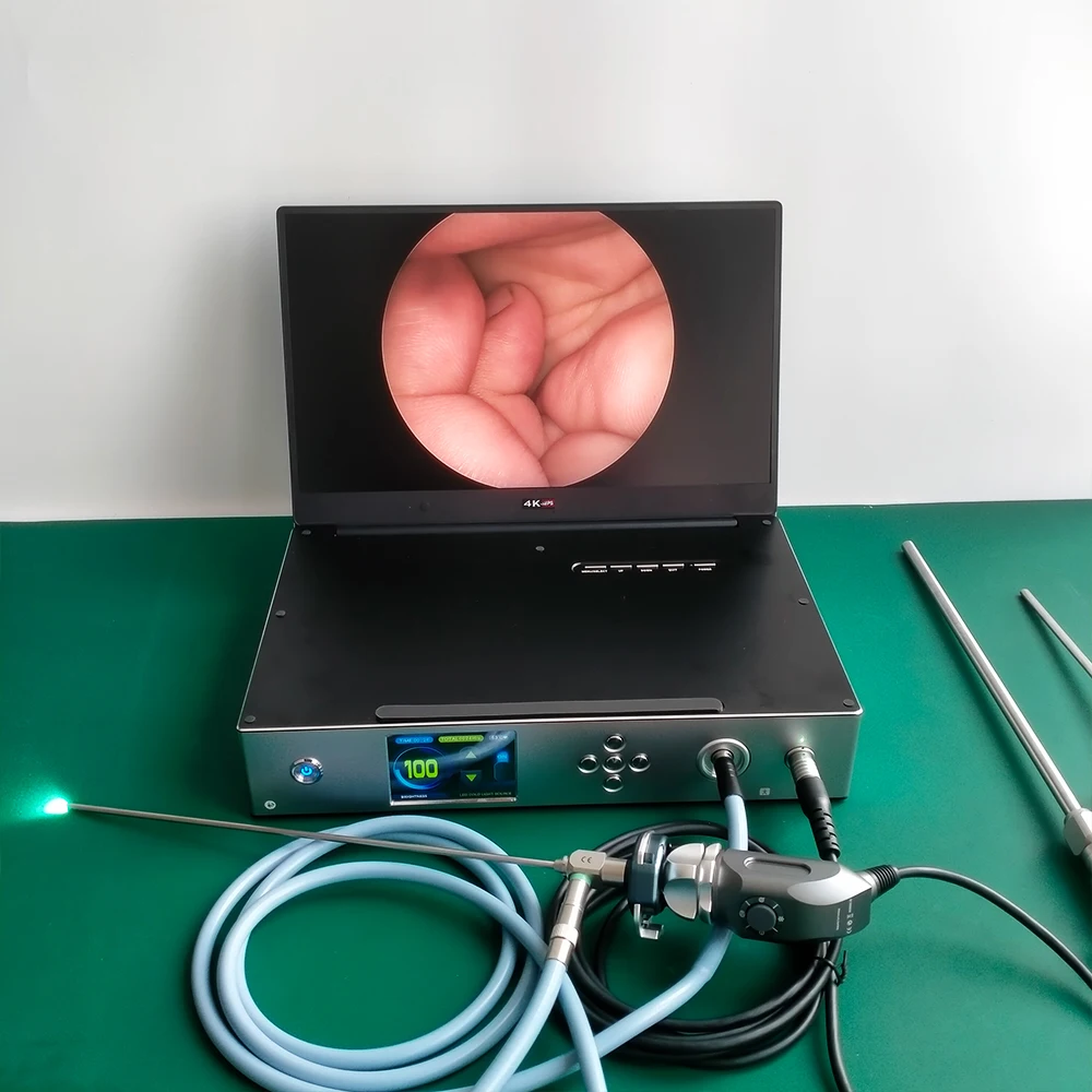 China top quality 11.6inch 15.6inch all in one FHD 1080P medical endoscope endoscopic ultra 4K  system with record