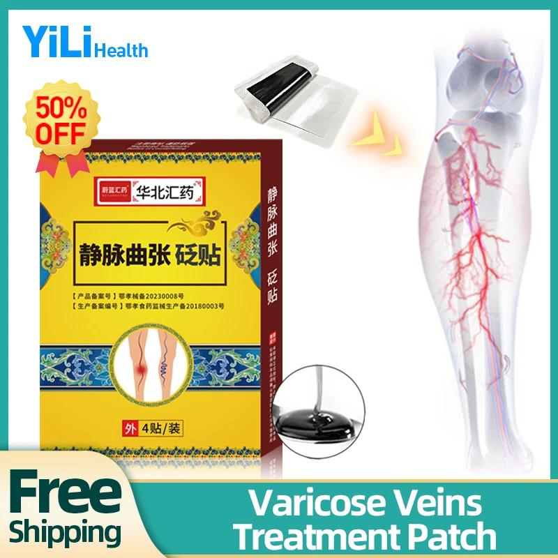 

Varicose Veins Patch Spider Legs Treatment Varicocele Vein Removal Vasculitis Phlebitis Vulvar Varicosity Repair Medicine