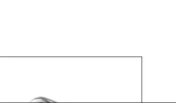 

4Pcs Dental Oral Cleaning Kit Scraper Mirror Scaler Set Plaque Remover Stainless Steel Care High Temperature Disinfection Tool