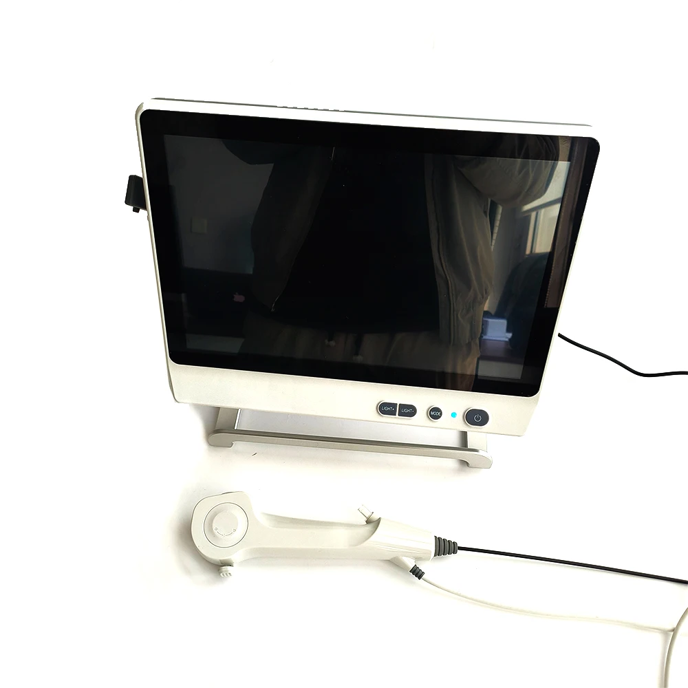 Camjoy 2.8mm HD Flexible Single Use Ureteroscope for Minimally Invasive Urology Procedures
