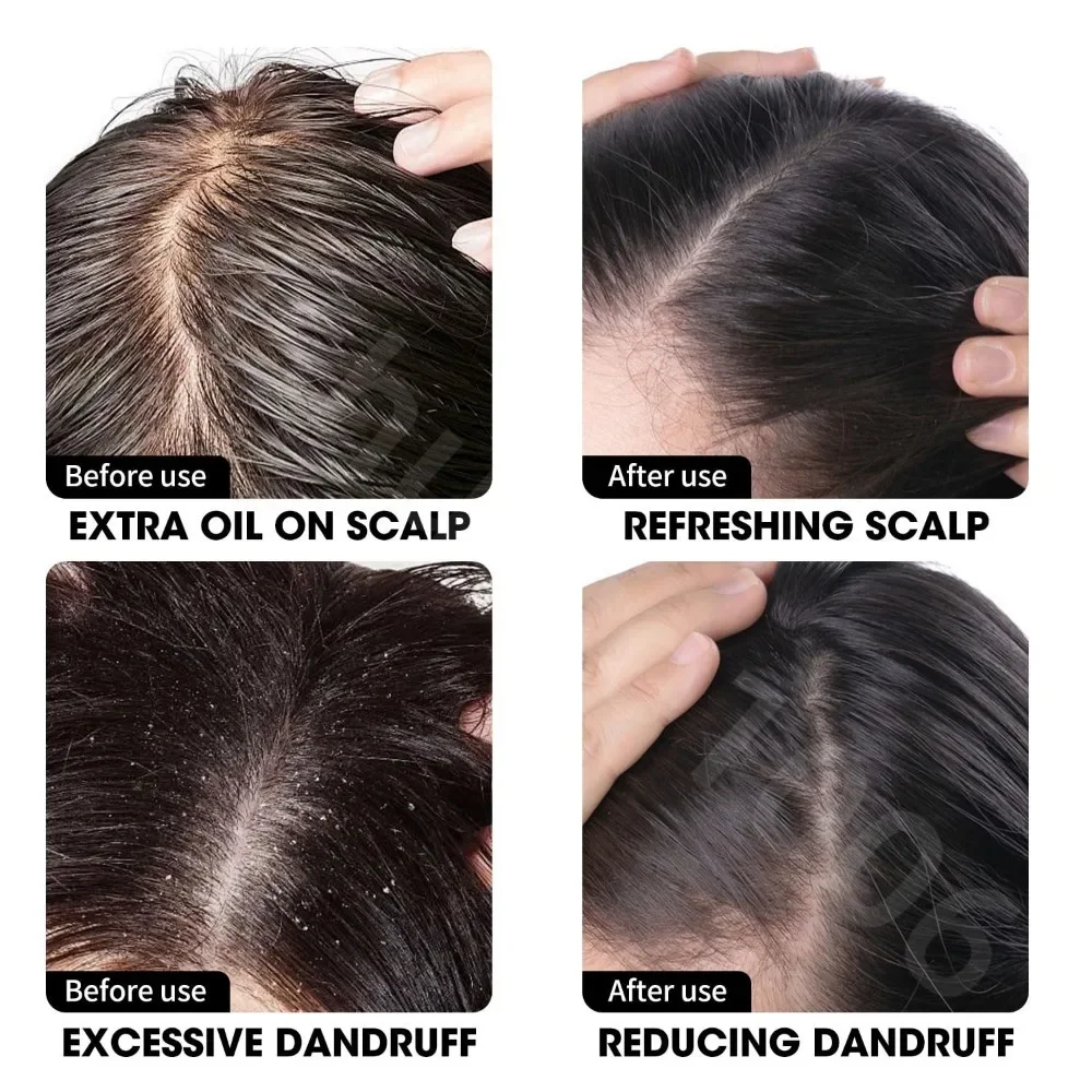 SCALP CLEANSING SHAMPOO RICH IN PLANT EXTRACTS Deep Cleans Anti-Dandruff Refreshes Scalp For All Hair Types