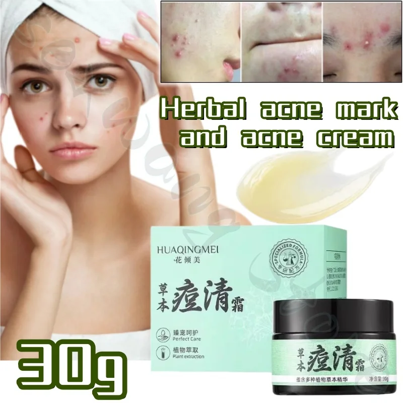 Herbal lightening acne mark cream improves closed acne, repairs skin, controls oil, shrinks pores, gently moisturizes skin 30ml