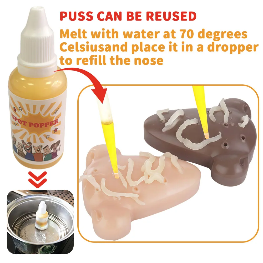 ストレス解消ニキビ潰しおもちゃ – 鼻のニキビを絞るフィジェットゲーム |   面白い感覚解消玩具 感情の発散ツール