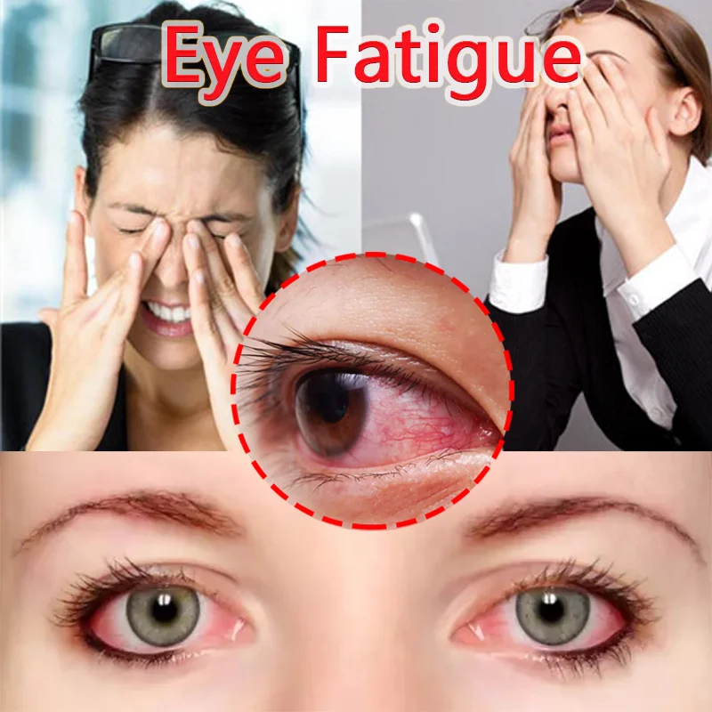 Improve Eye Fatigue, Dry Eye Syndrome, Relieve Vision, and Moisturize Eyes