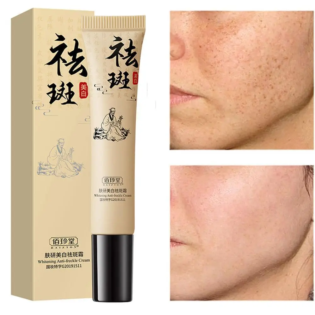 

Whitening Freckle Cream Removes Melasma Yellow Spots Lightening Pigmentation Brightening Skin Tone Korean Skin Care