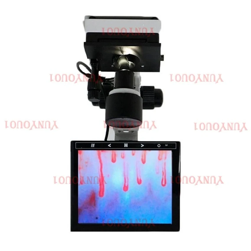 

ADigital Microscope Zoom Nailfold Capillary Microcirculation Detector Blood Microcirculation Analyzer with 7/8/9" Digital Screen