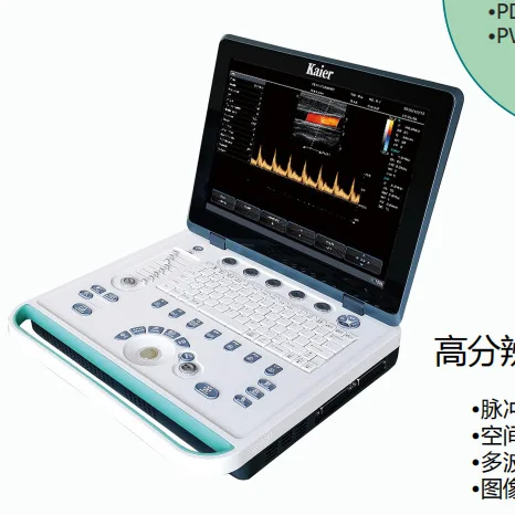 Notebook Color Ultrasound Used Abdominal Cardiac Gynecological Obstetric Urological Organ Pediatric Vascular 15 Inch LCD Monitor