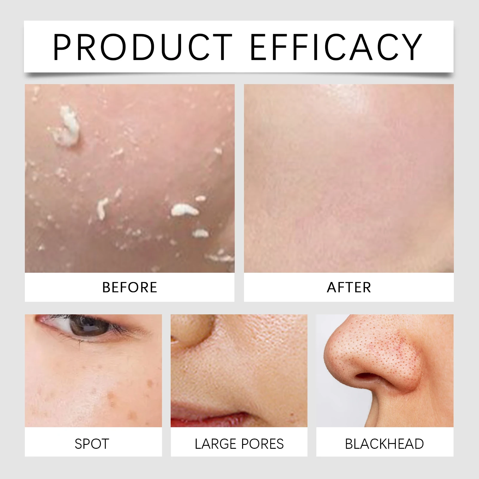 تونر تقشير حمض الساليسيليك 100 مللي جهاز تقليل المسام للتحكم في العيوب مستخلص البابايا السائل ترطيب الوجه للبشرة المعرضة لحب الشباب #4