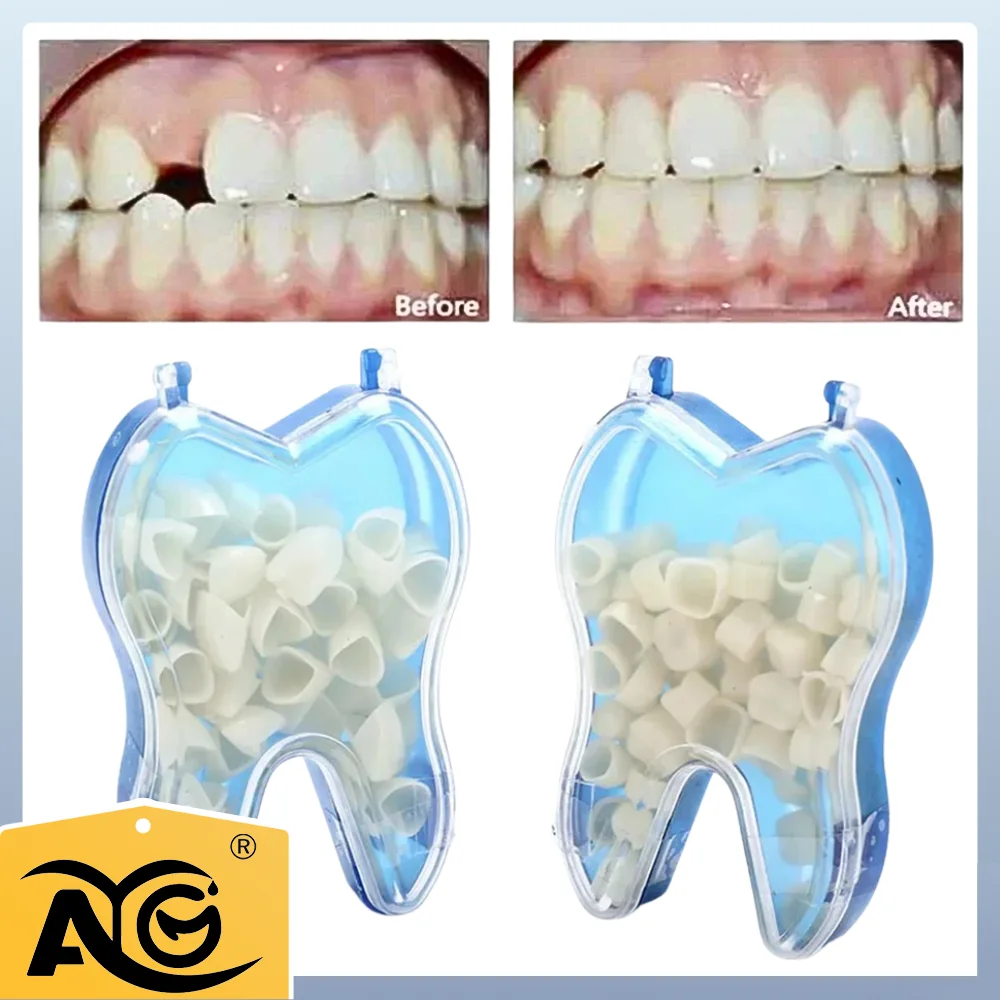 

AG 50 Pcs/Box Dental Temporary Crown Kit Anterior Front Molar Posterior Teeth Veneers Dentistry Tooth Whitening Dental Tools