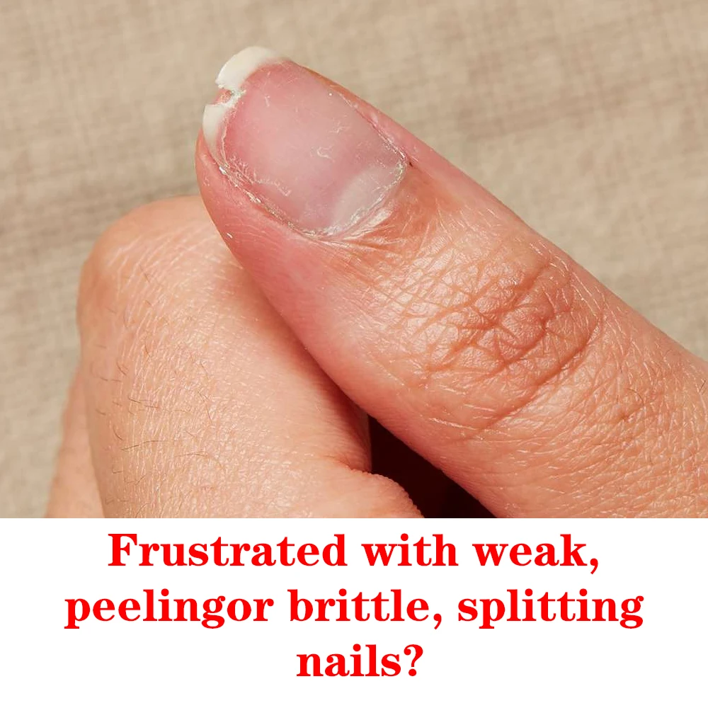 كوديس جل فوري مسمار تصلب إصلاح نمو الأظافر علاج البولندية تنمو قوي الصلب سمكا الأظافر مانيكير معطف فوقي زيت مشرق