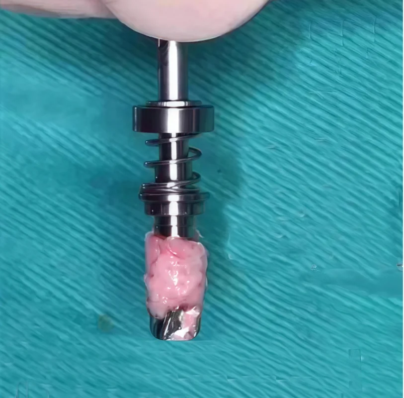Dental Trephine Burs Implant Spring Bone Harvesting Drill Self-grinding Bone Powder Collection Drill GBR