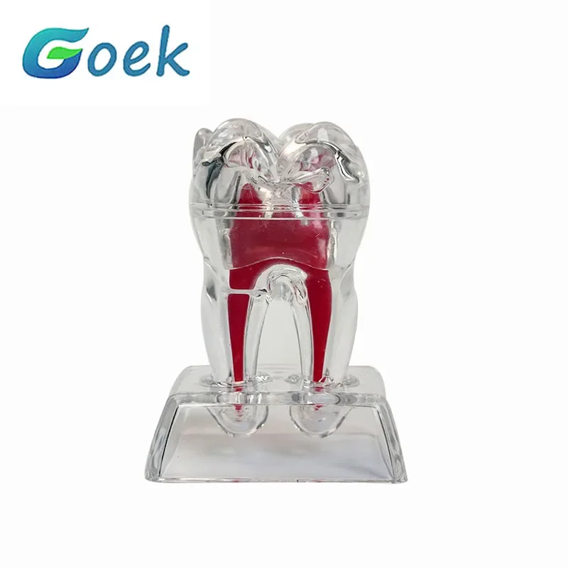 Modèle anatomique dentaire Transparent lumineux détachable, décomposition à un seul dent, ornements de clinique de dentisterie, 4 dents 70mm