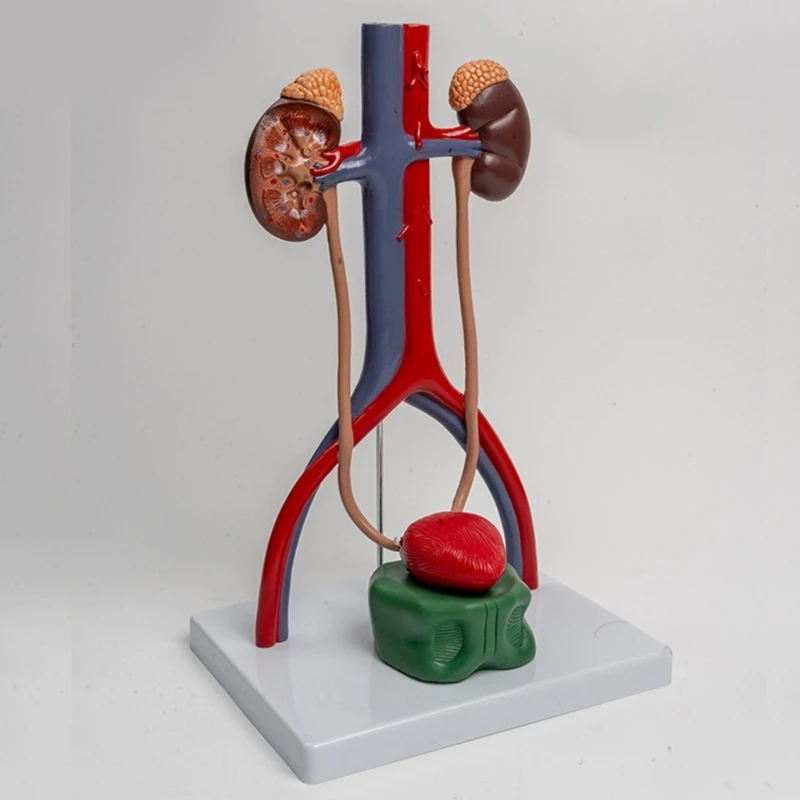 A9LC 1: 1 Scale Anatomical Urogenital System Model for Diseases Study Lecture Report,