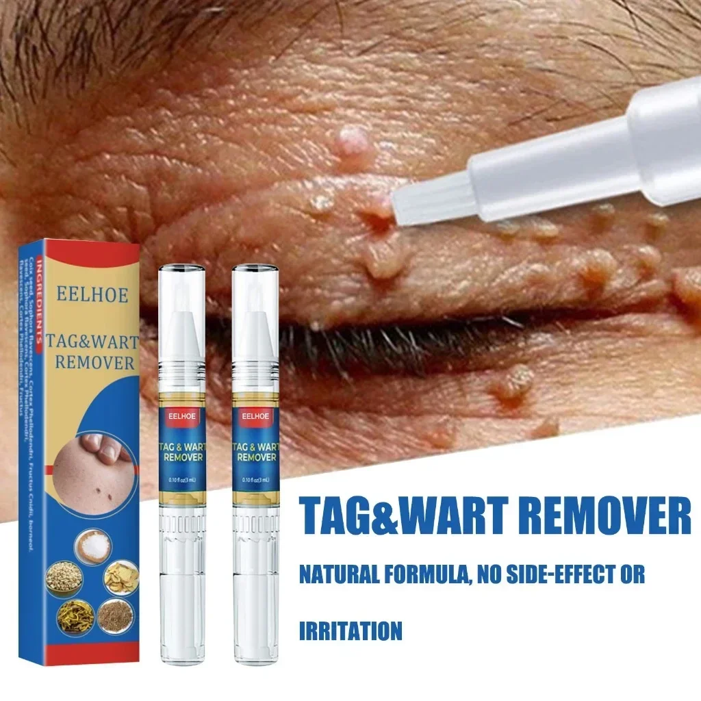 EELHOE Wart Remover Pen Gentle Ingredients Body Wart Remover Cleansing Skin Skin Care Pen