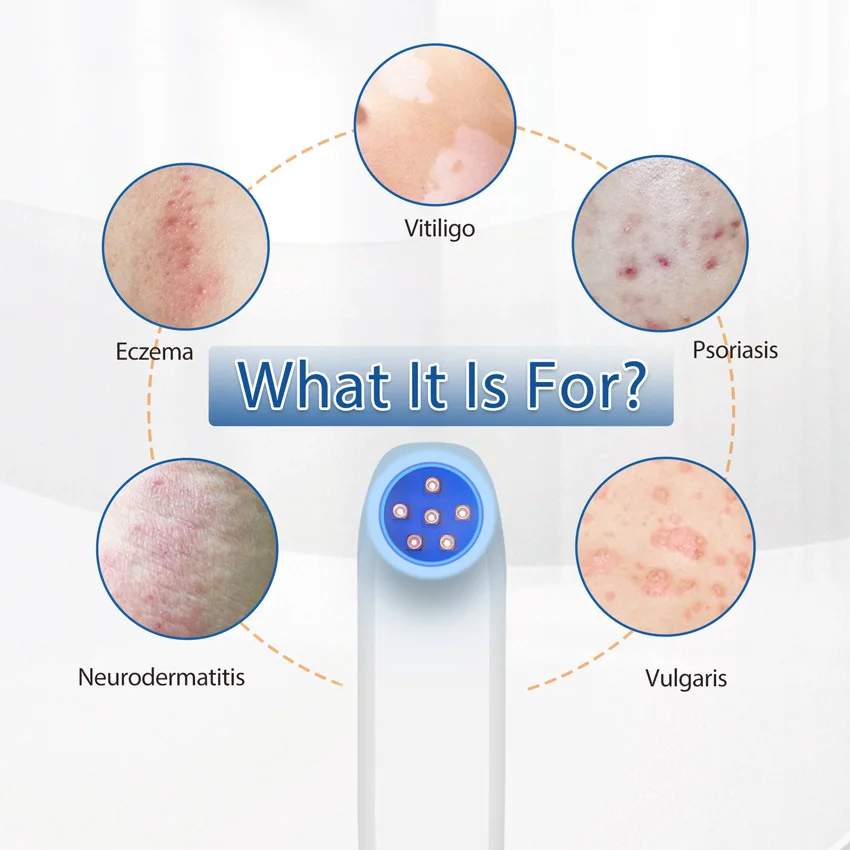 308nm UVB Light Phototherapy Device 6 Diodes Handheld UVB Lamp For Vitiligo Psoriasis Treatment LCD Display Adjustable Dose Home Use