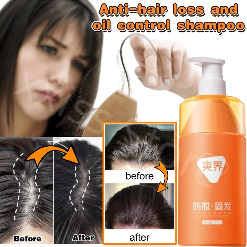 

Anti-hair Loss Shampoo Improves Scalp, Removes Dandruff, Relieves Itching, Smoothes and Oil-controls Herbal Essence Shampoo