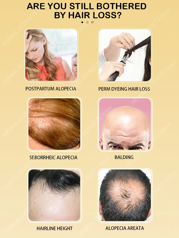 

Hair Loss Care Solution, Strong and Tough, Hair Roots, Ginger Hair Care, Hair Damage Repair