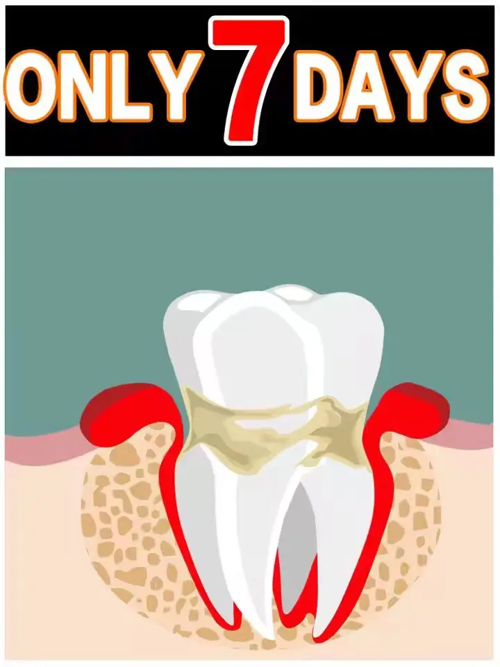 

Sore gums Periodontitis Don't worry! Eᴀsɪʟʏ ʀᴇᴠɪᴛᴀʟɪᴢᴇ ɢᴜᴍs ᴀɴᴅ sᴀғᴇɢᴜᴀʀᴅ ᴛᴇᴇᴛʜ ɪɴ ᴊᴜsᴛ 7 ᴅᴀʏs
