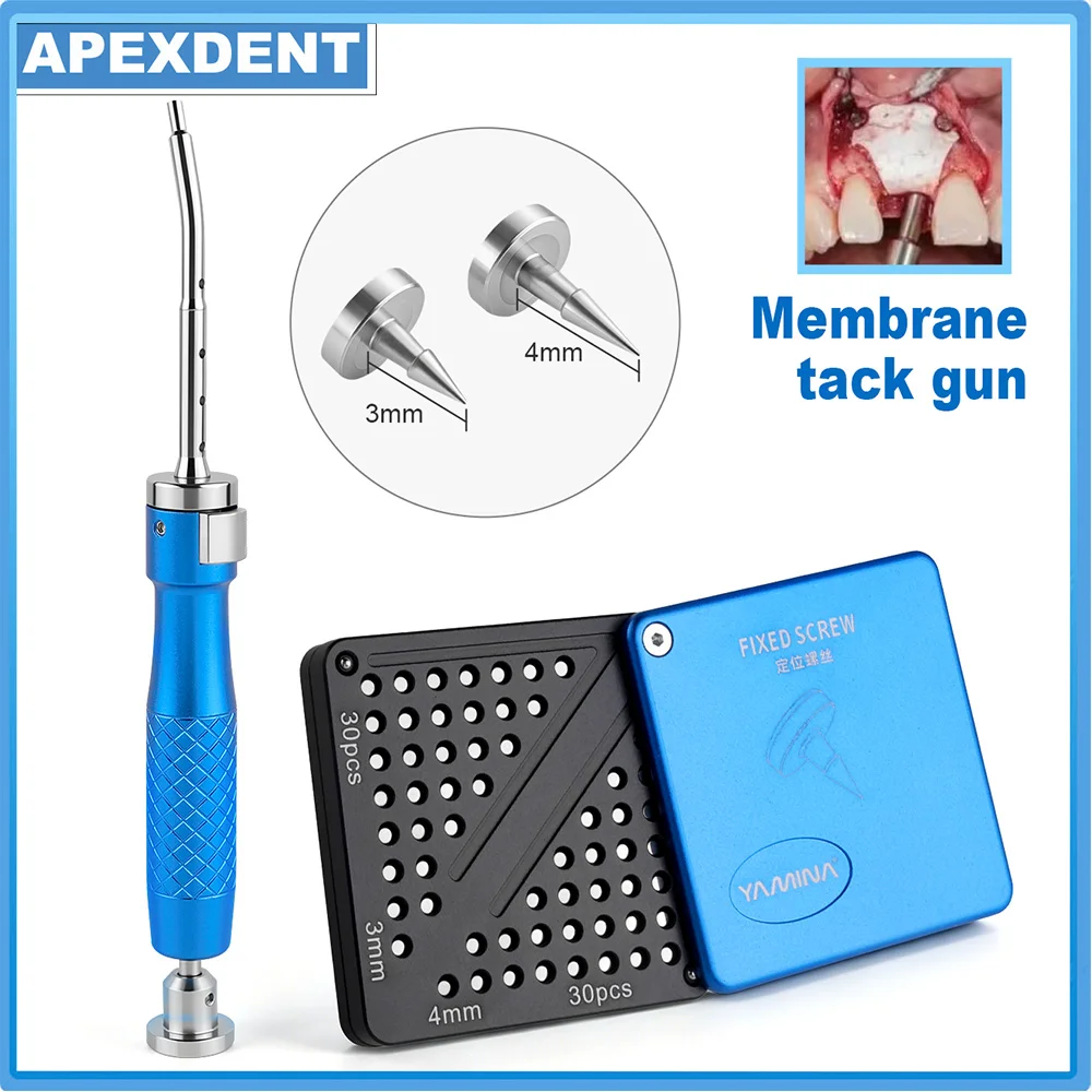 APEXDENT Dental Implan Membrane Tack Kit One-Click Automatic Tacker With 30Pcs 3/4mm Fixed Screw Dentistry Equipment