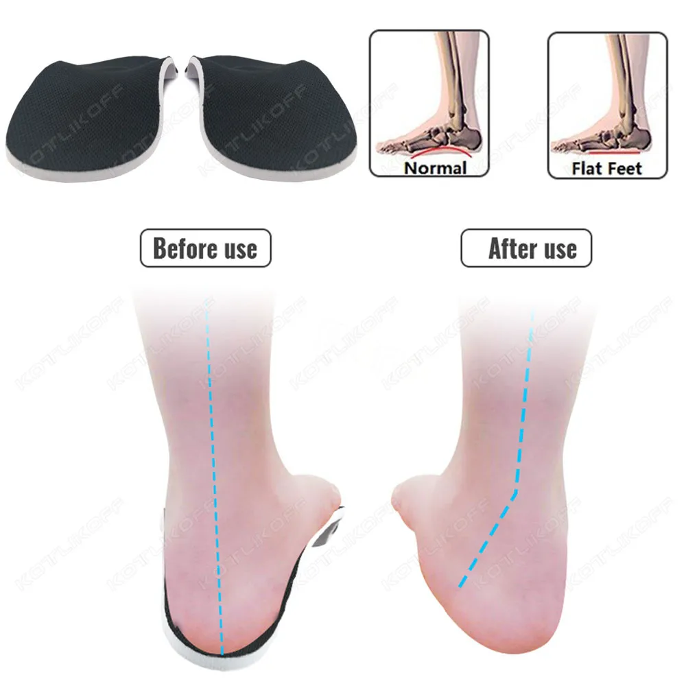 Premium Orthotic High Arch Support Insoles Gel Pad 3D Arch Support Flat Feet For Women/Men Orthopedic Shoes Sole Foot Pain