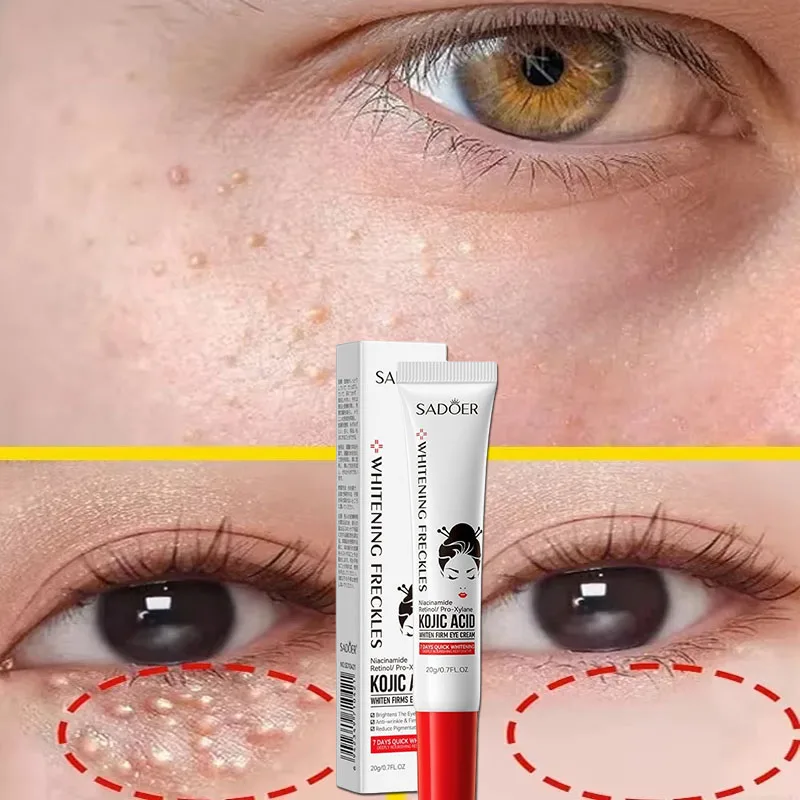 Crème dissolvant de granulés de graisse pour les yeux, améliore le sac pour les yeux, estompe les ridules, cernes, hydratante, Anti-poches, Lifting, raffermissant, soins pour les yeux