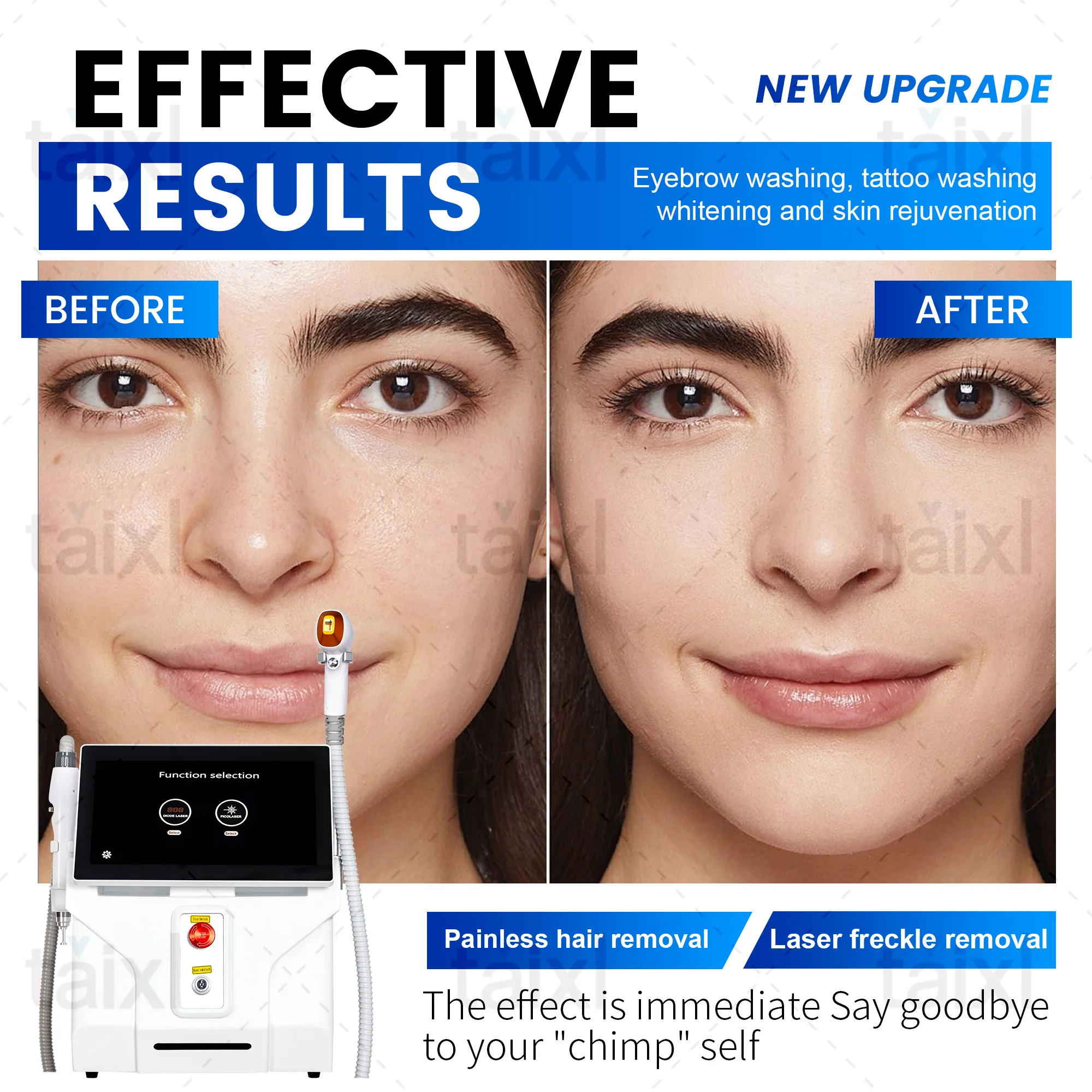 

Sapphire 808 Diode Laser Painless Hair Removal 2 In 1 Laser Tattoo And Pigmentation Removal Suitable For Face And Body