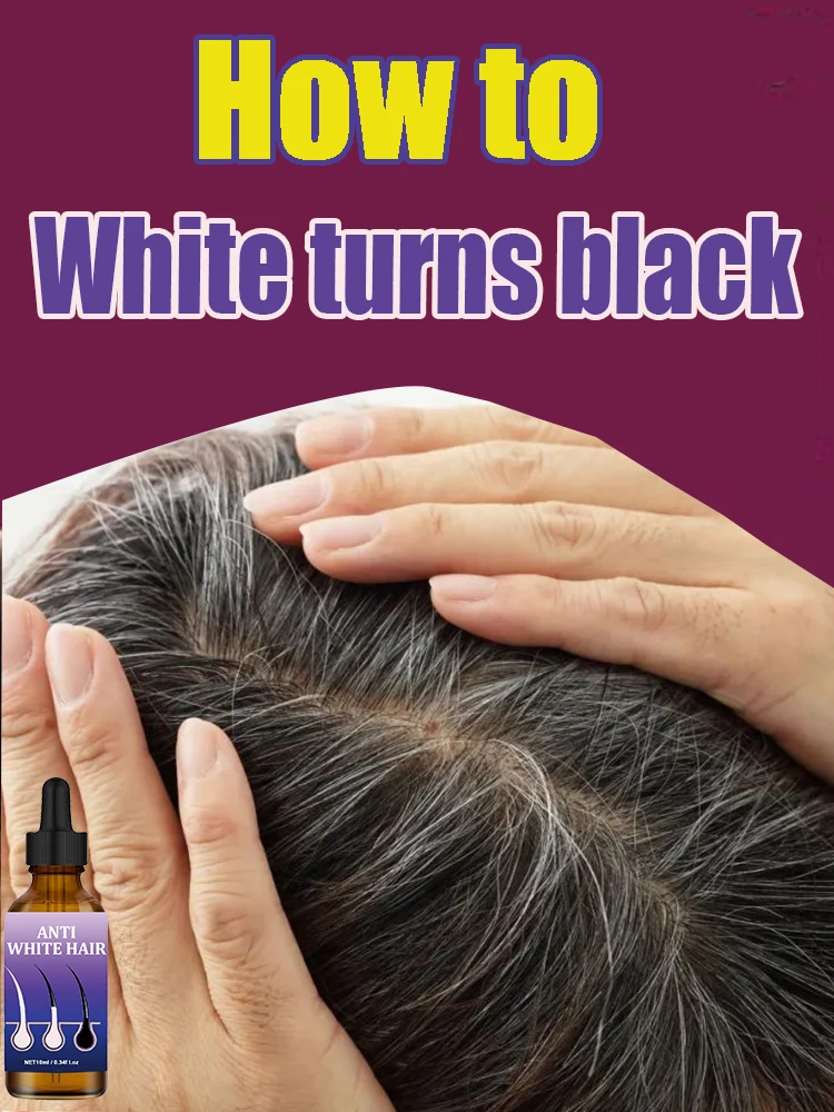 

Anti-gray Hair White To Black Natural Color Repair Nourishessence Anti Loss Care for Men Women