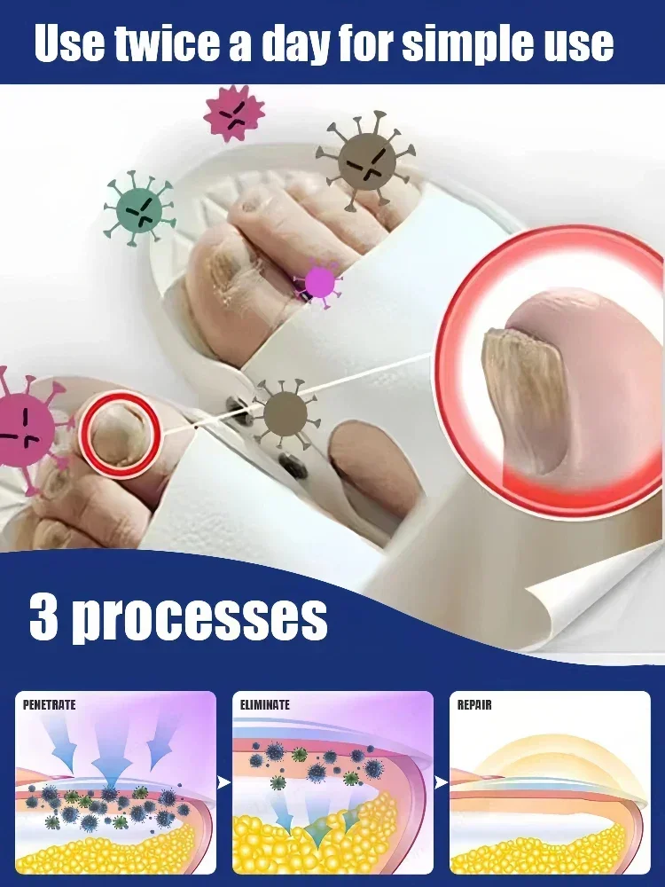 Quickly eliminate fungus and restore healthy nails