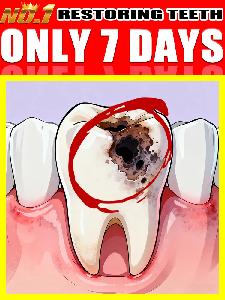 

2025 Newest Dental Care Product: Eᴀsɪʟʏ Sᴀʏ Gᴏᴏᴅʙʏᴇ ᴛᴏ Cᴀᴠɪᴛɪᴇs