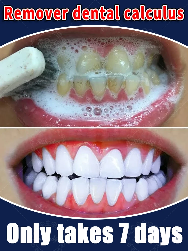 

2025 Hot Products Teeth Whitening Mousse Removes Plaque and Stains Deep Cleans Fresh Breath Oral Hygiene Dental Tools