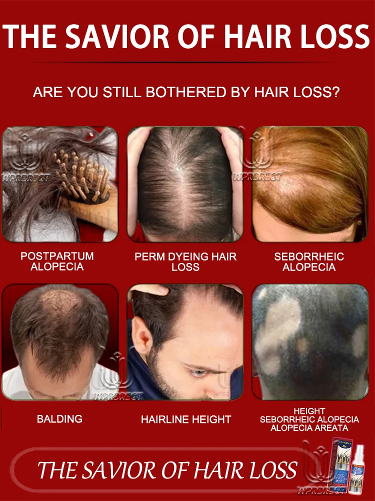 تركيبة مغذية جديدة للجذور لزيادة حجم الشعر 10 سم