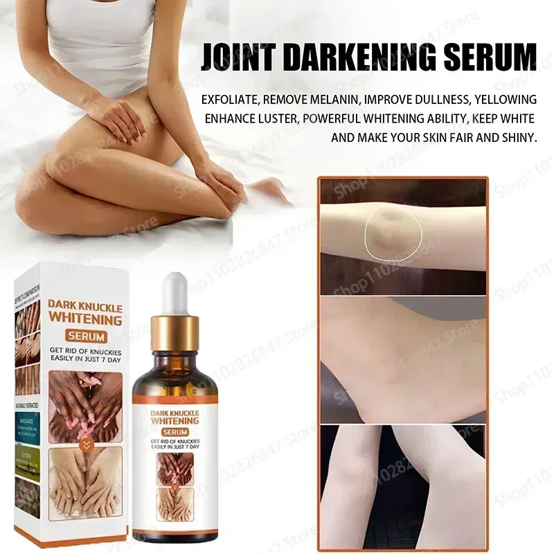 knuckles whitening Essence For Lip Areolas Private Parts Tender Remove Intimate Melanin Skin Care Whitening Dark Spot Body Serum