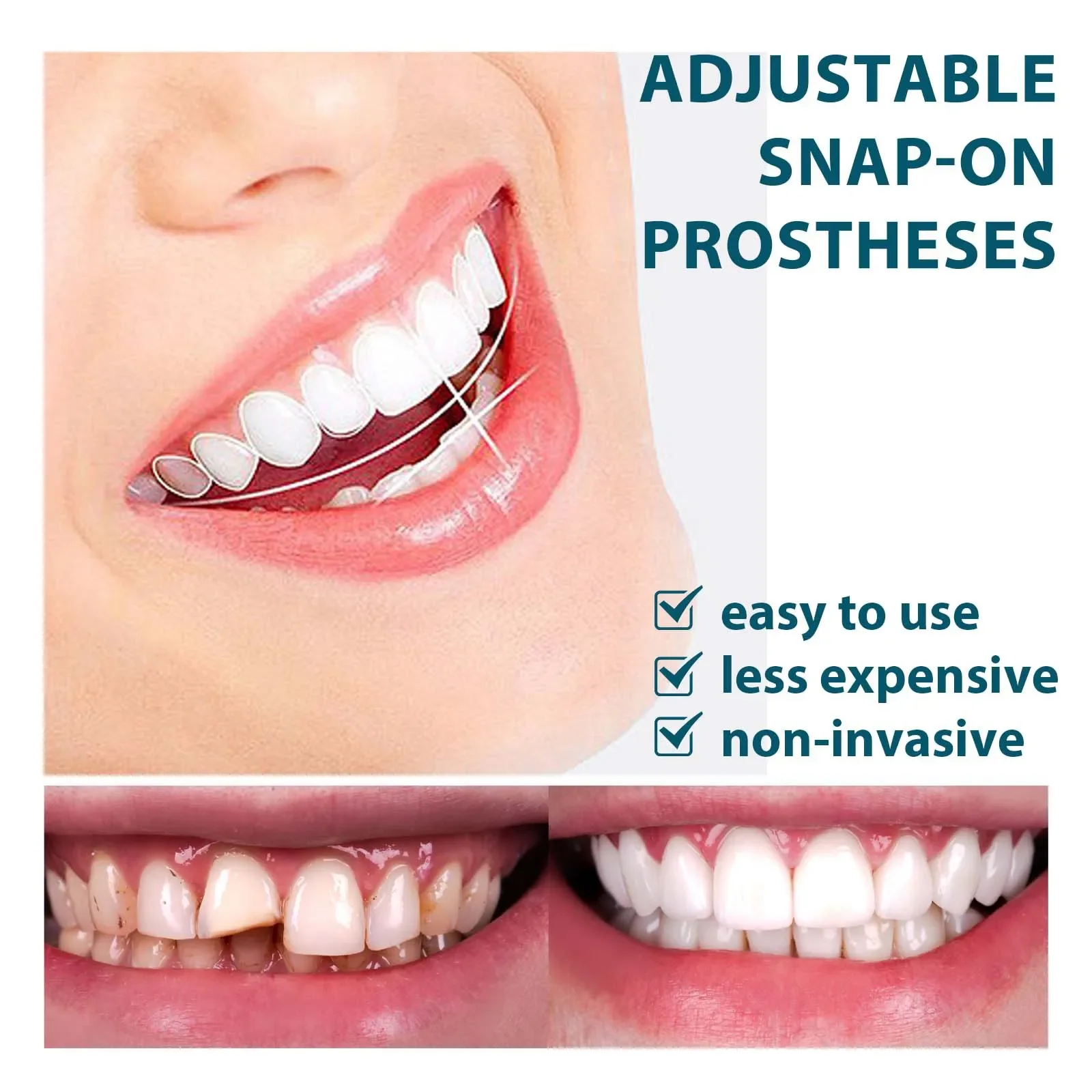 Teeth Veneers Snap on Cover Gaps Broken Stained Whitening Orthodontics Oral Hygiene Smile Repair Temporary Fake Tooth Prostheses
