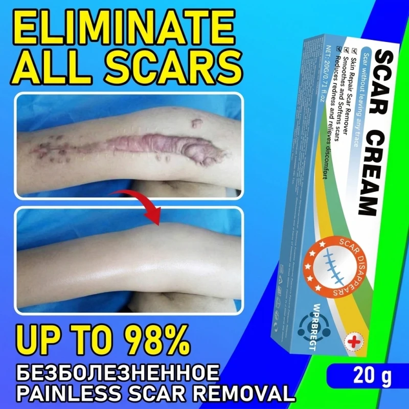 Repair & Scar-Fading Cream—Fades both new and old scars; improves the appearance of stretch marks, surgical scars, burn marks, and acne marks; and gently cares for the skin.