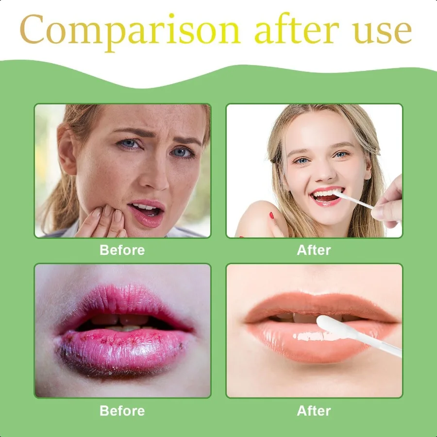 100本入り リップオイル綿棒 オイル綿棒アプリケーター 唇と歯茎の保護、乾燥防止、保湿、歯のホワイトニング前の使用に