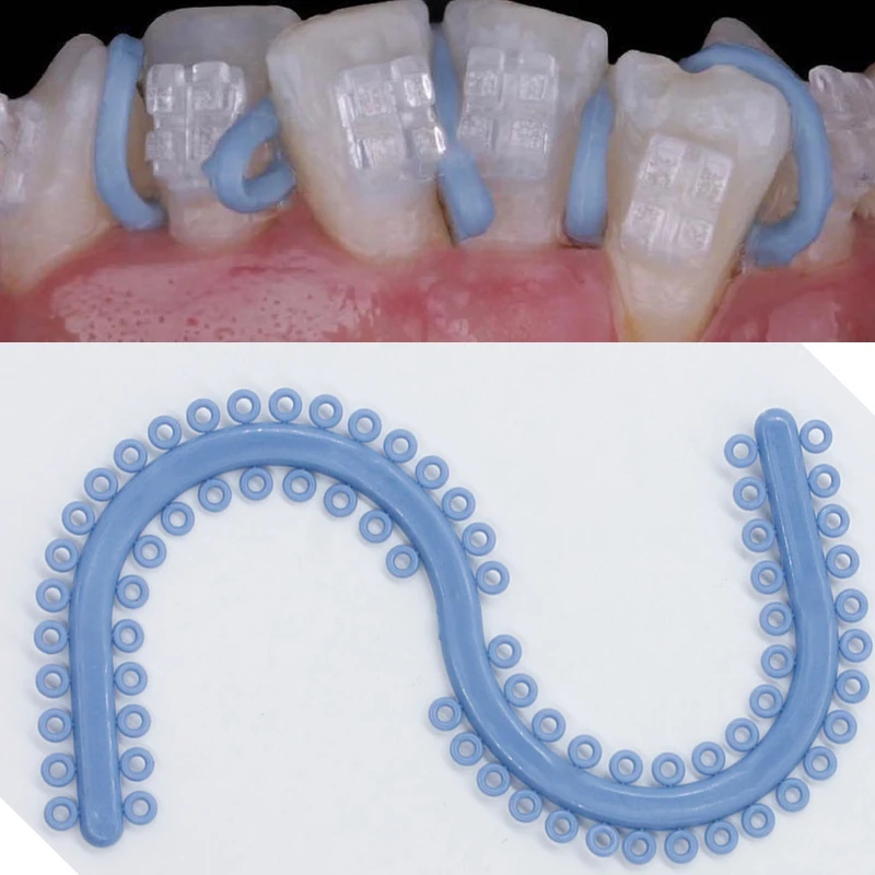 700 stücke zahn ärztliche kiefer ortho pä dische Separator elastische Zahnmedizin Odontologia Zahnspangen elastische Gummi Kreis Zahnspangen