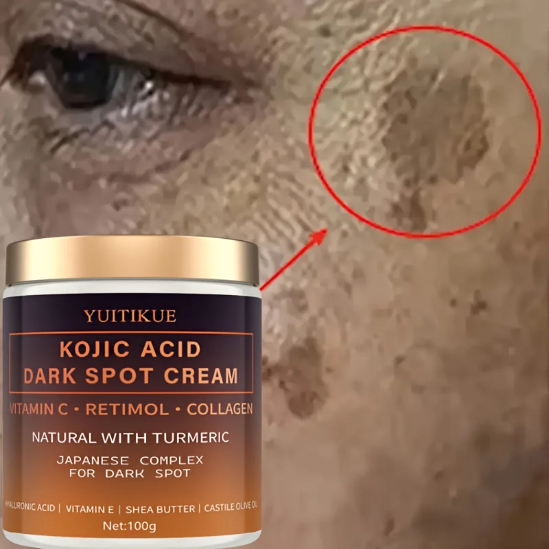 Crema decolorante de arbutina, vitamina C, retinol, colágeno, curcumina natural, ácido hialurónico, vitamina E, manteca de karité, aceite de oliva de ricino.