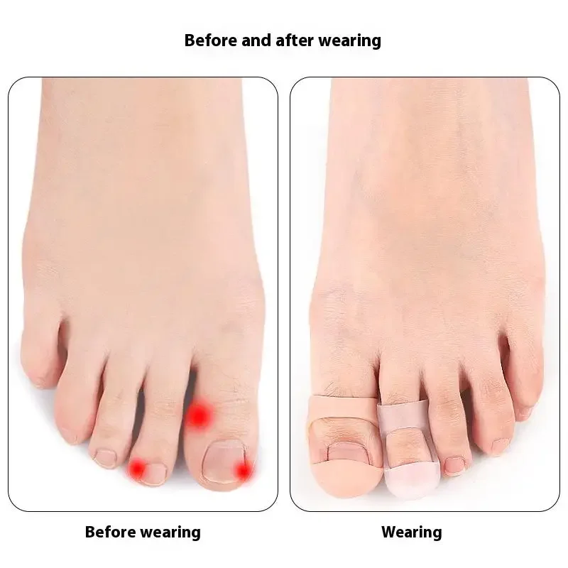 Separator Palców Ochraniacz Palców Aplikator Usuwacz Odcisków i Skórek Korektor na Haluksy Narzędzia do Pedicure Tuba Przeciwbólowa Pielęgnacja Stóp