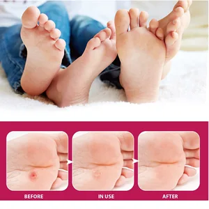 8ベストセールストウモロコシ除去石膏-6