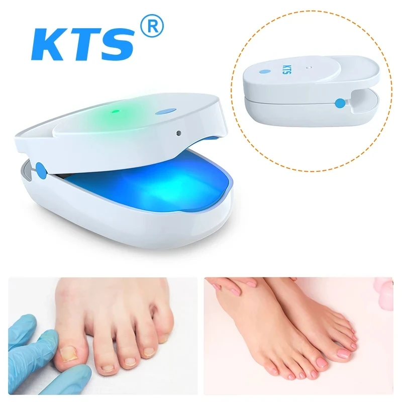 Nail Fungus Cleaning Device Toenail Fungus Cleaning Machine Portable Fungus Discolored Remover for Discolored Thickened Toenail