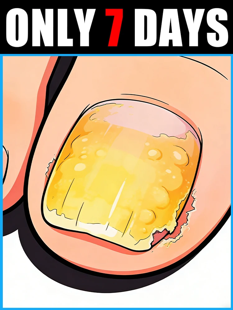 

5ᴛʜ Gᴇɴ Nᴀɪʟ Cᴀʀᴇ: Gᴇɴᴛʟᴇ & Eғғᴇᴄᴛɪᴠᴇ ғᴏʀ Fᴜɴɢᴀʟ Nᴀɪʟs