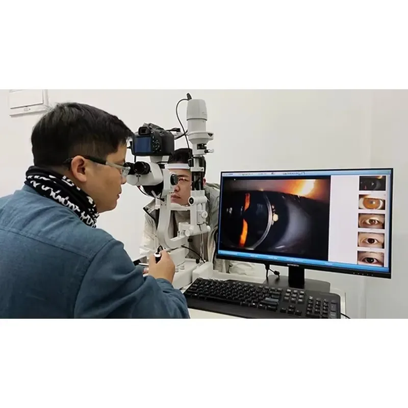 2026 Hot Sale S5D Slit Lamp Microscope Price CE Approved 5 Step Slit Lamp with Imaging System