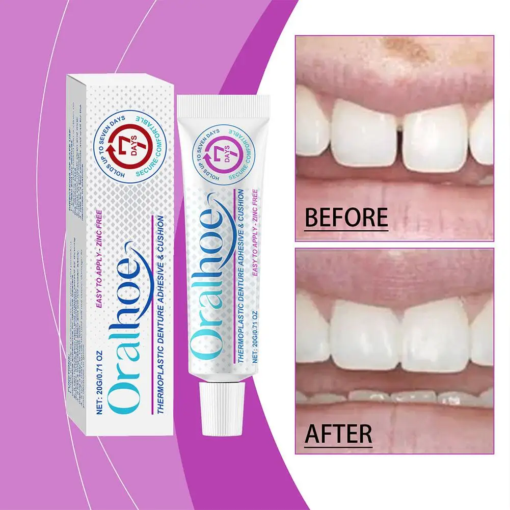 Thermoplastic Denture fixing adhesive Glue Teeth Care Denture Silicone Reline Kit Adhesive Cushion Friction Fixed Dentures image 3