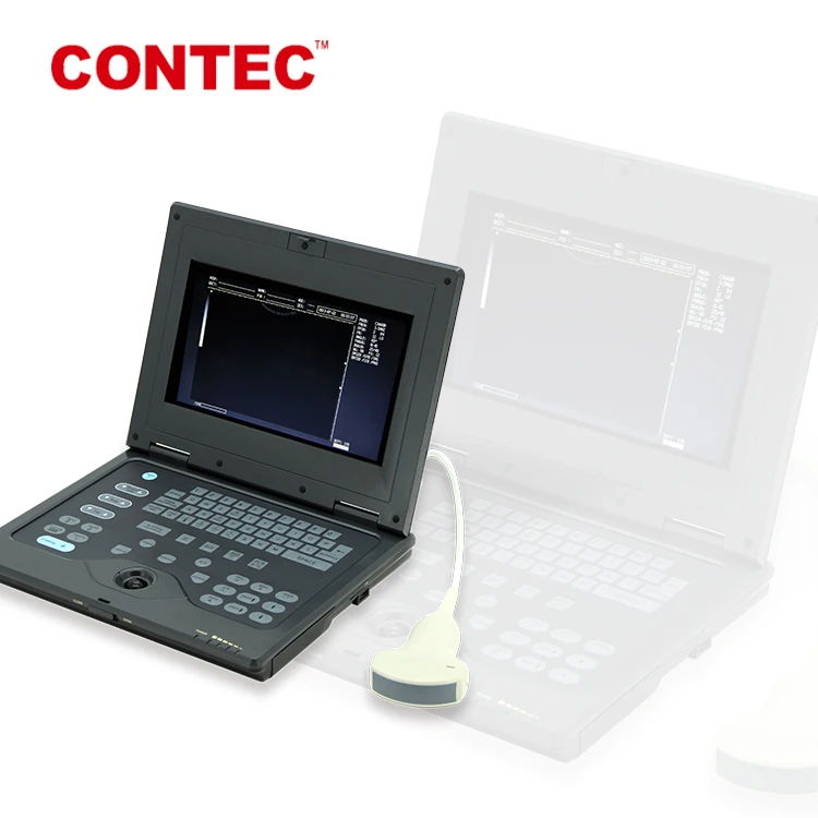 Limited stock only!!! Laptop portable doppler ultrasound CMS600P ecografo doppler