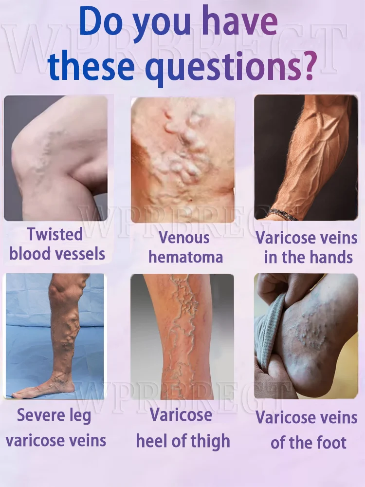 Vein laser pointer, a new upgrade