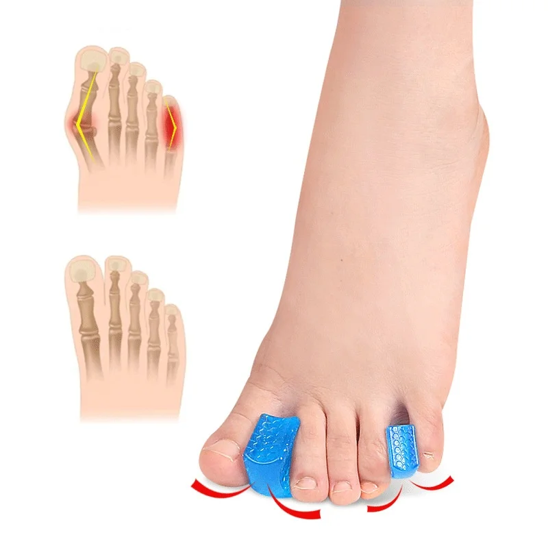 Forefoot Pad Square-shaped Hallux Valgus Dance Practice Helps With Toe Separation And Overlap Toe Separators