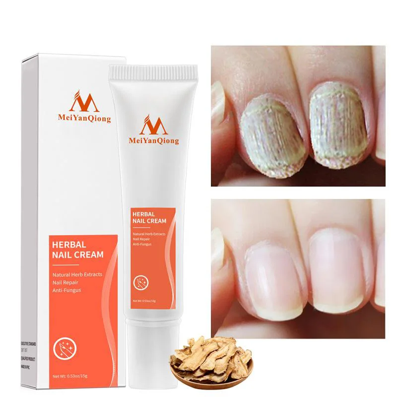 Nail Repair Cream Essence Nourishing Brighten Foot Finger Care Nail Serum Nail Treatment Cream Women Men Nails Products